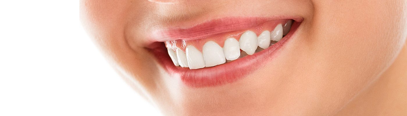 teeth-whitening-blog-1